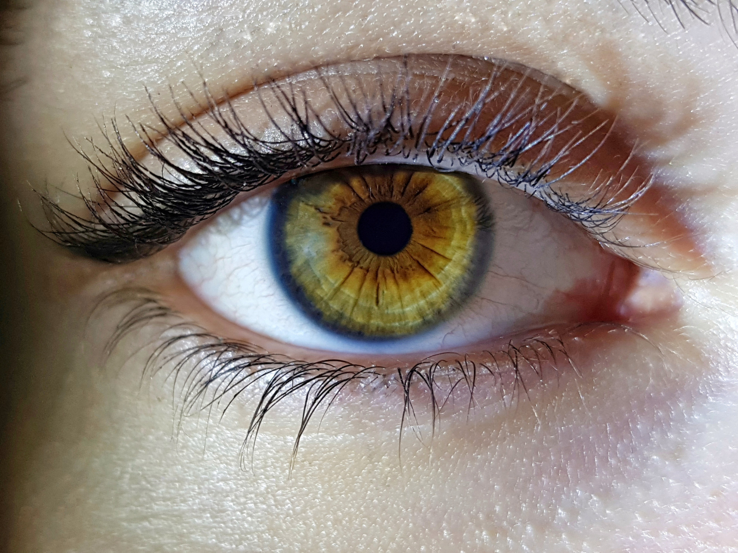 Iridology in Burlington